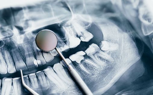 Nueva condena por intrusismo a un protésico dental en Las Palmas con pena de prisión por lesiones