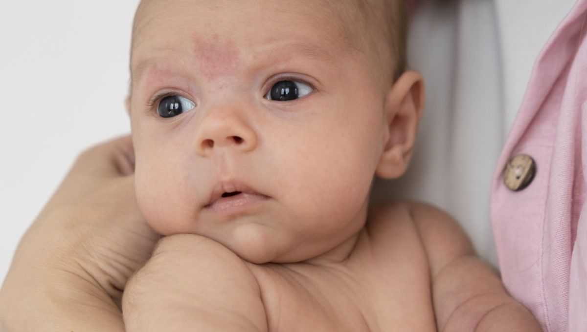 Bebé con sarpullido de sudamina en el rostro (Foto. Freepik)