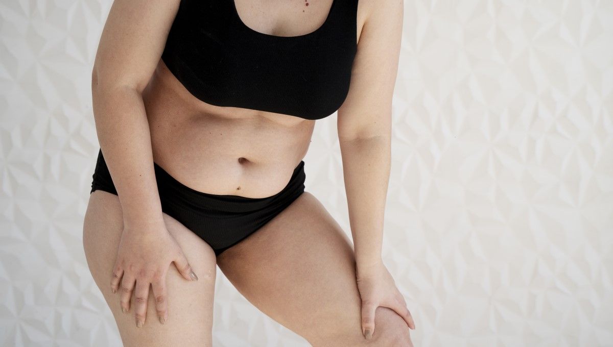 Grasa localizada en abdomen y glúteos (Foto. Freepik)