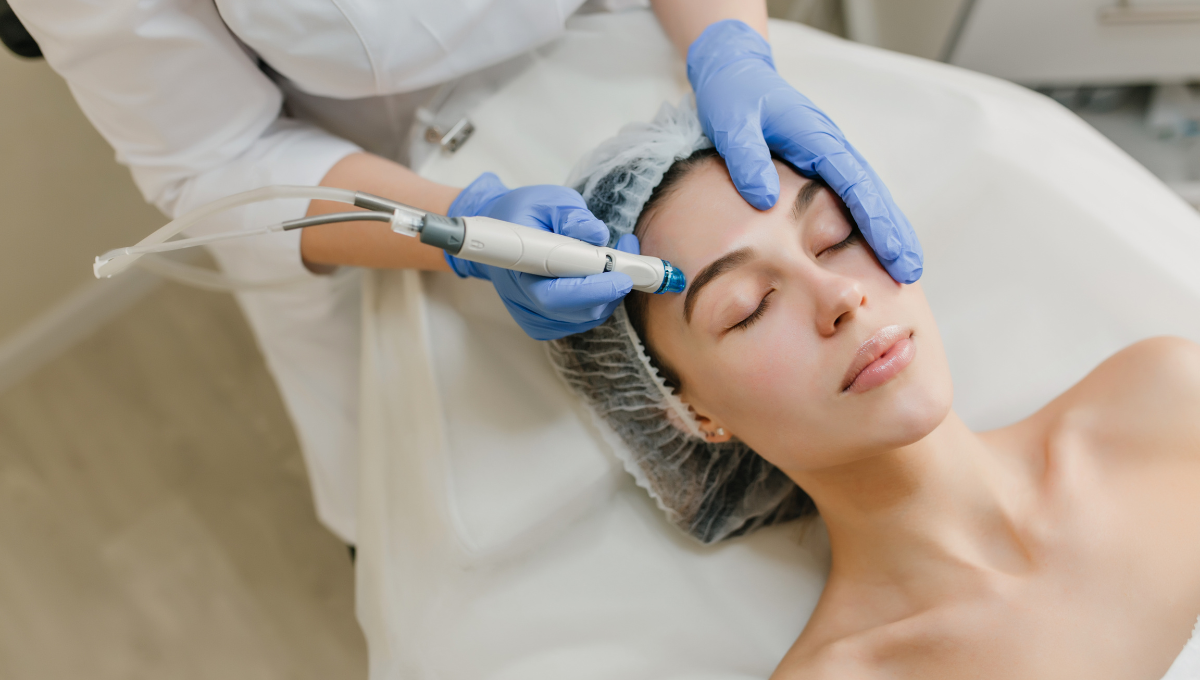 El microneedling es la solución para rejuvenecer la piel a principios de otoño (Foto. Freepik)