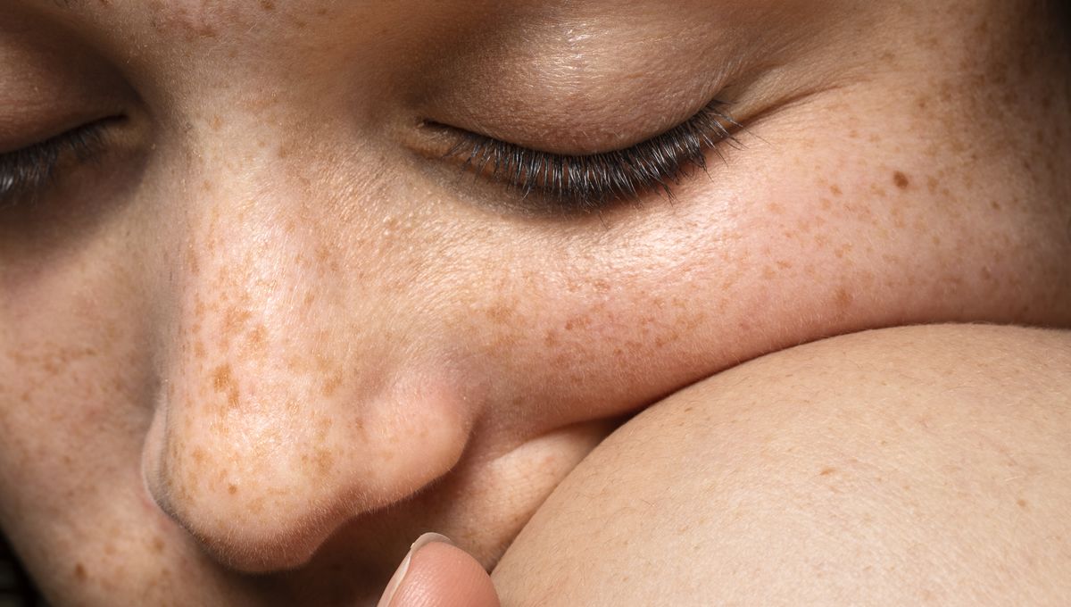 El melasma es una condición cutánea común en mujeres durante la edad fértil (Foto. Freepik)