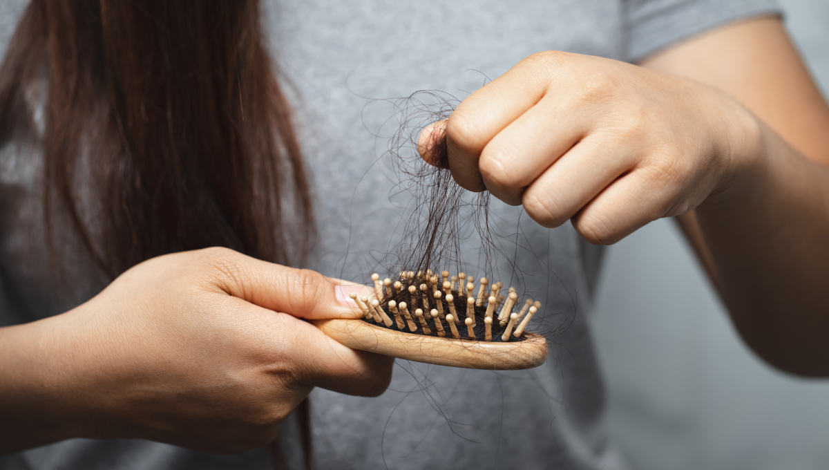 La caída de pelo estacional, un proceso natural (Foto. Canva)