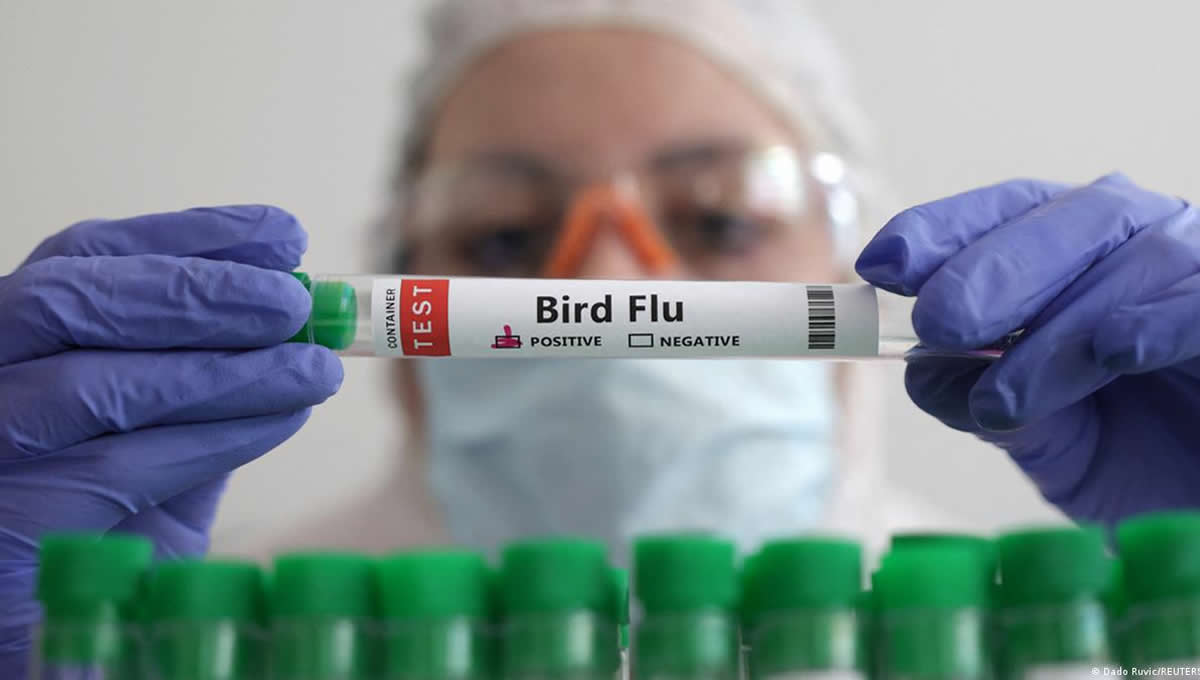 Test de gripe aviar, la zoonosis con potencial pandémico en la actualidad. (Foto: Reuters)