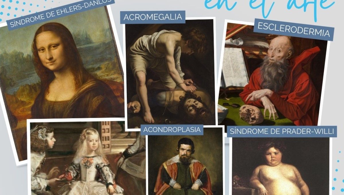 Ejemplos de enfermedades raras en el mundo del arte, expuestos por el Dr. Ricardo Gil (Foto. @dricardogil)