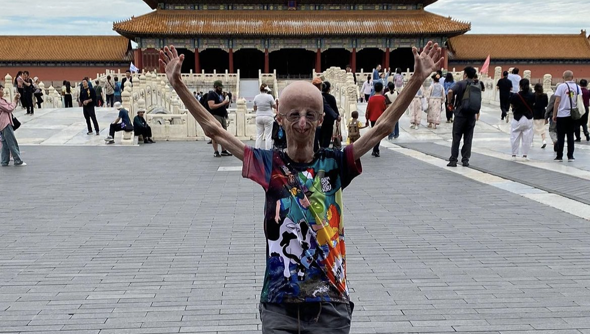 Muere Sammy Basso, la persona con progeria más longeva del mundo (Foto. Instagram)