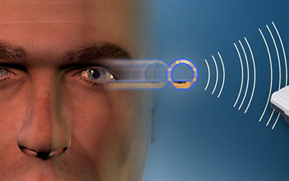          Desarrollan un sensor intraocular que mide la presión en pacientes con glaucoma