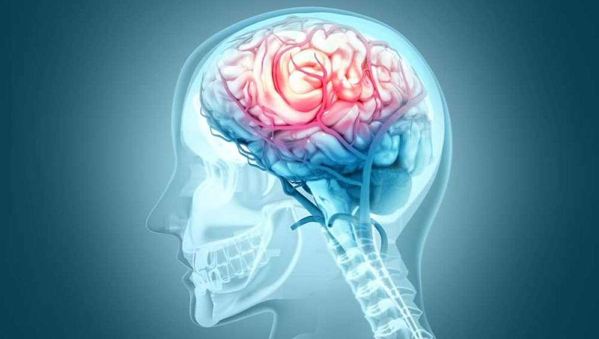 Imagen del cerebro (Foto. Quirónsalud)