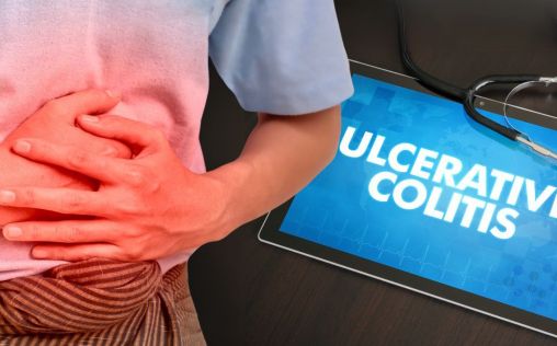 Identifican un gen que predice si un paciente sufrirá colitis ulcerosa grave