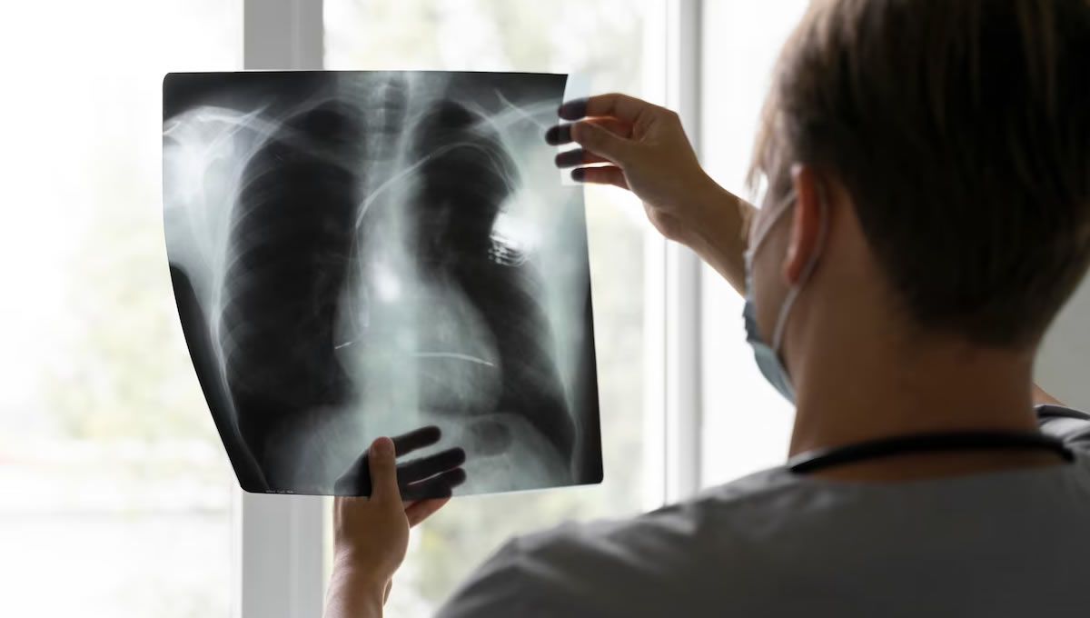 Doctor observa la radiografía de un pulmón (FOTO: Freepik)