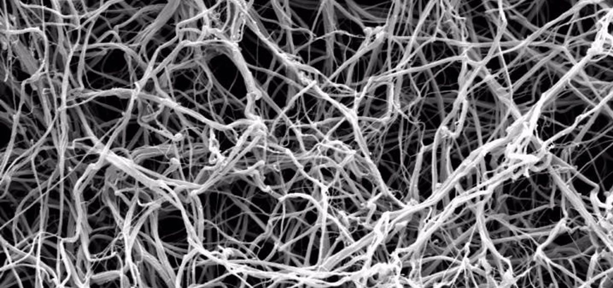 Imagen de fibras de fibrina obtenida con un microscopio electrónico (Fuente: LEEDS UNIVERSITY)