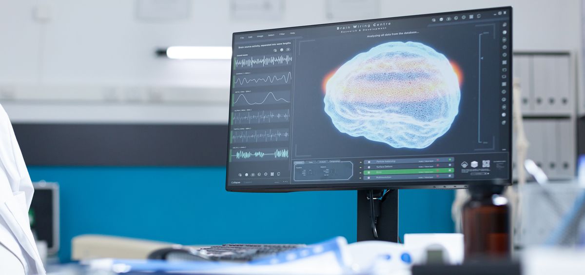 Un nuevo modelo de aprendizaje automático señala escaneos cerebrales  anormales en tiempo real