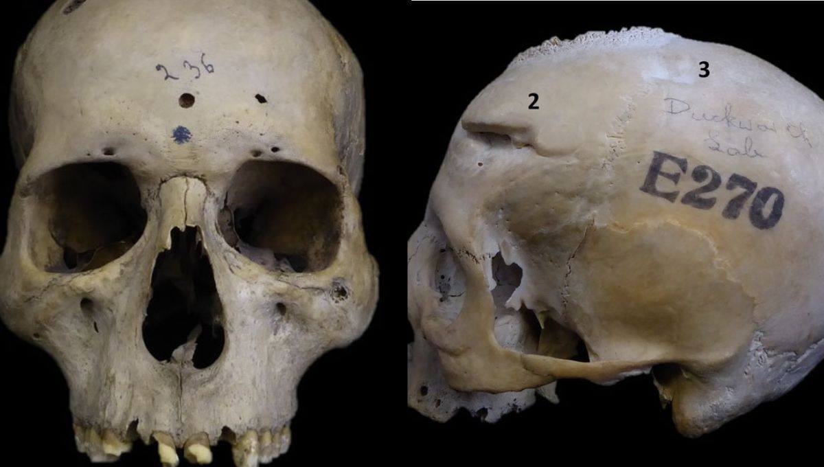 Imágenes de los cráneos (MONTAJE: ConSalud.es)