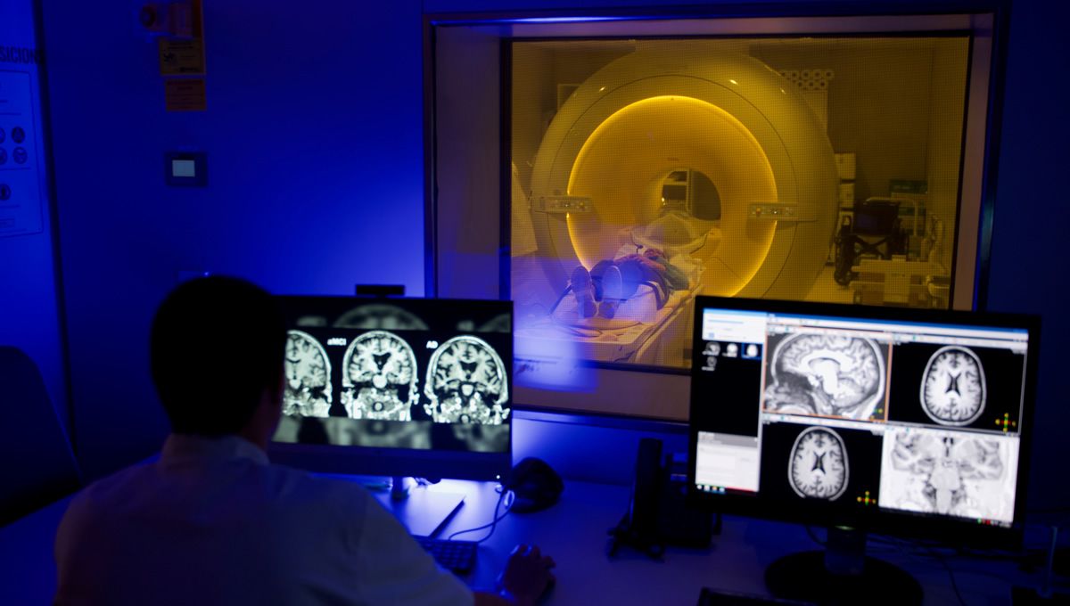 El flujo sanguíneo del cerebro podría disminuir en etapas asintomáticas del alzhéimer (Foto: Philips, Fundación "la Caixa", Fundación pasqual maragall y Barcelonaβeta )