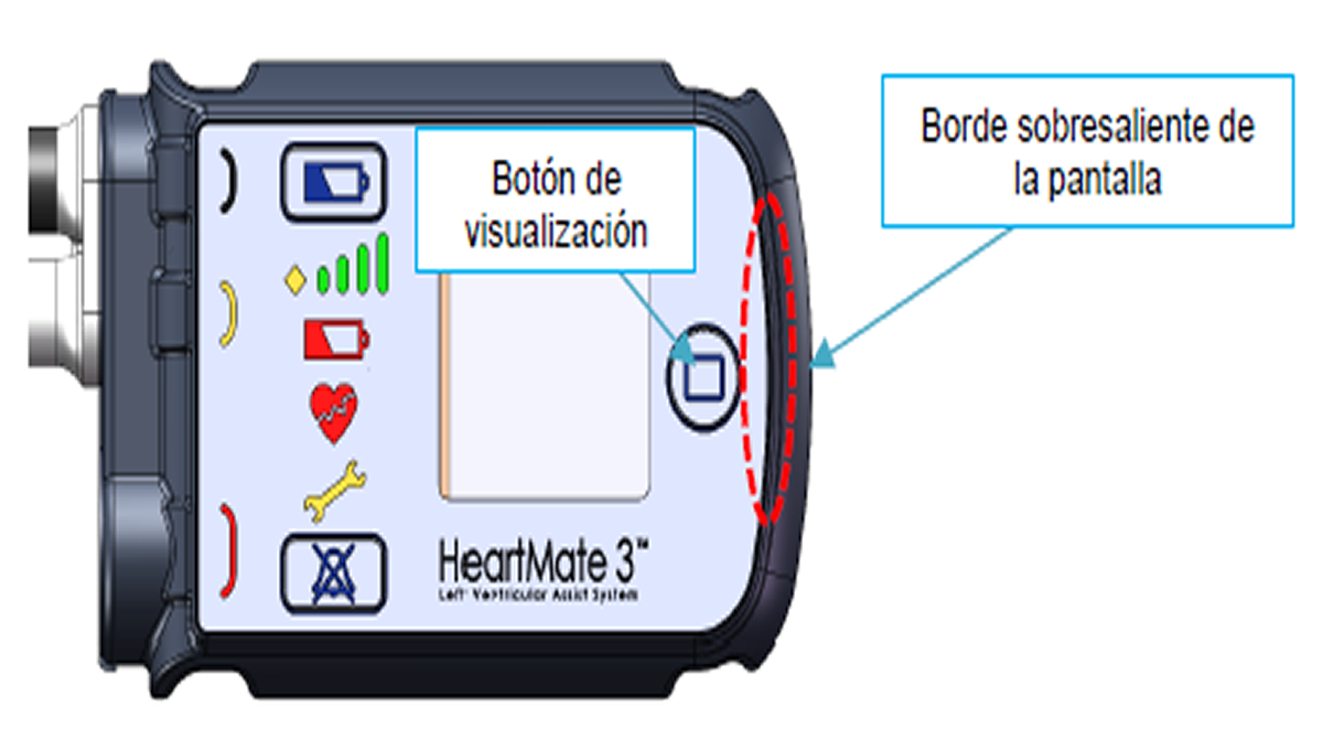 Controlador del sistema de asistencia ventricular Heartmate 3 (Foto: AEMPS)