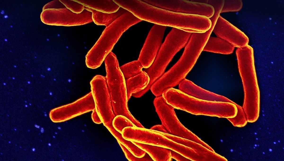 La bacteria causante de la tuberculosis en Extremadura. (Foto: CSIC - Europa Press)