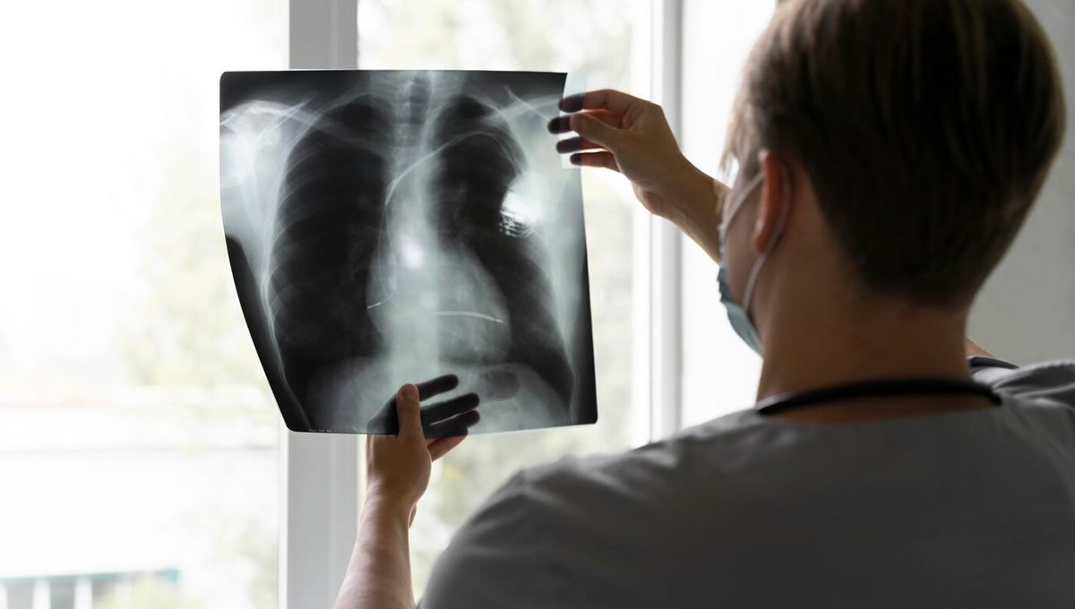 Medico estadounidense observando una radiografía de pulmón. (Foto: Freepik)