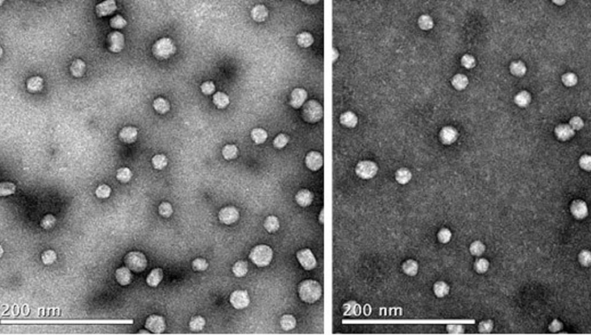 Investigadores desarrollan péptidos que combaten la agregación de colesterol LDL y la aterosclerosis (Foto: CSIC)