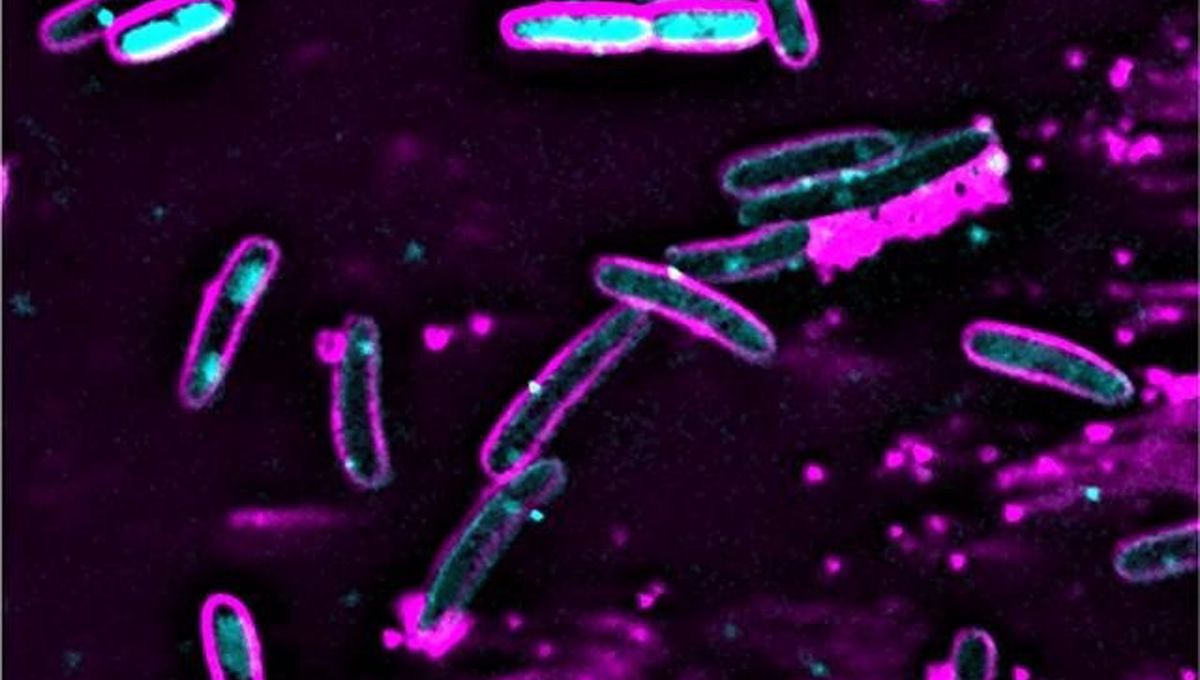 Las células de E. Coli que contienen el sistema CBASS destruyen sus propios genomas después de la infección con el bacteriófago lambda (Foto: UC San Diego Health Sciences / Archivo EP)