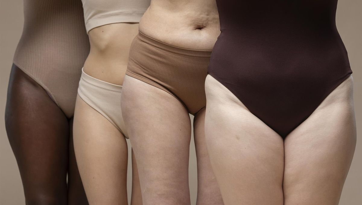 La invisibilización del lipedema (Foto: Europa Press)