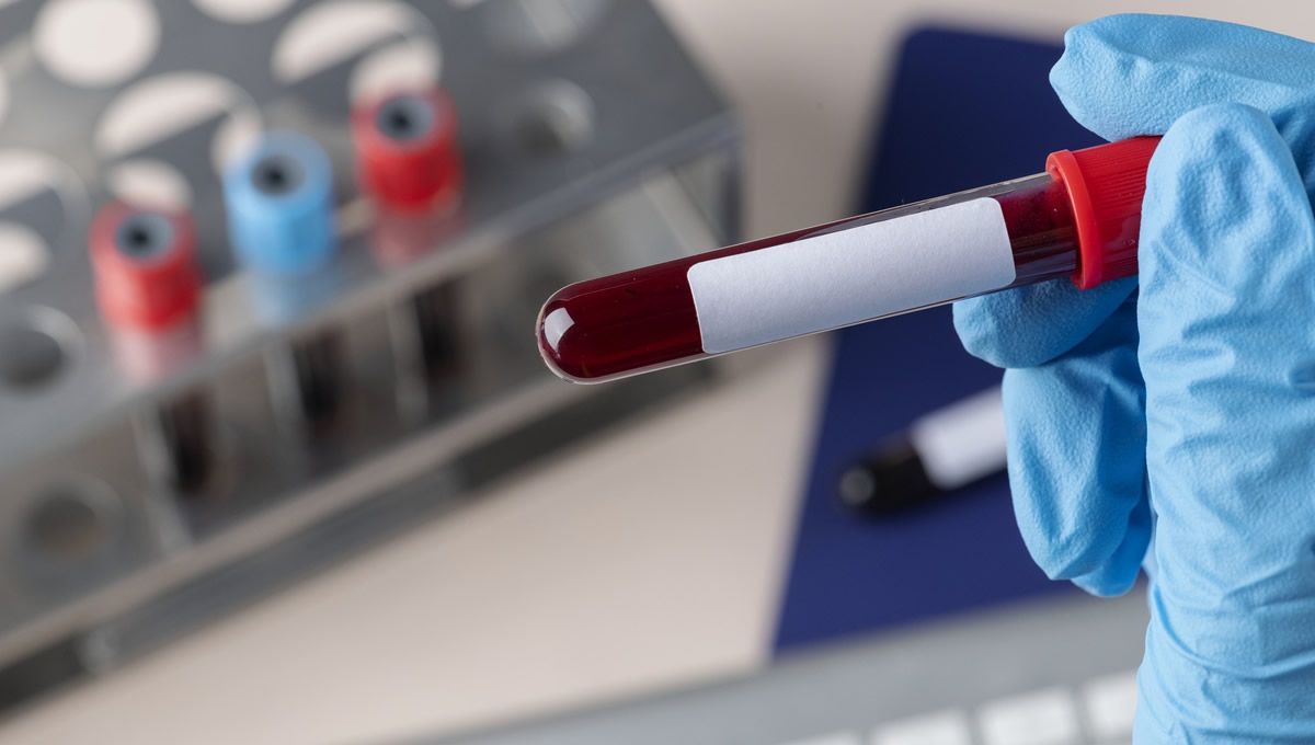 Test en sangre para diagnosticar la hepatitis C. (Foto: Freepik)