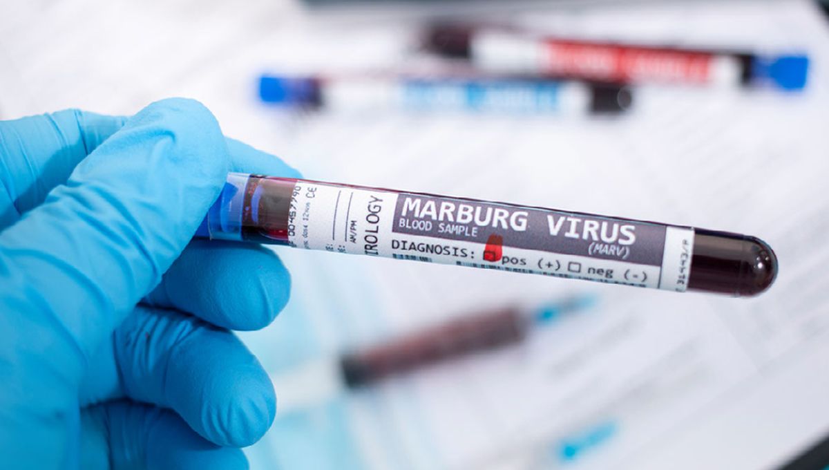 Mueren ocho personas por el virus de Marburgo. (Foto: Hospital Clínic Barcelona)