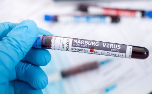 Mueren ocho personas en Tanzania por un brote sospechoso del virus de Marburgo