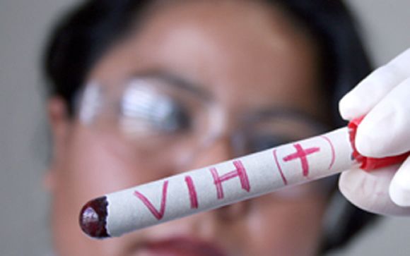 Cerca del 50% de los pacientes con VIH en tratamiento tienen más de 50 años